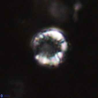 Cribrocorona echinus VR 22929