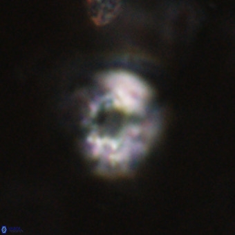 Cribrocorona echinus VR 22930