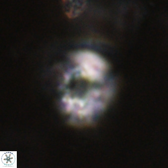 Cribrocorona echinus VR 22930