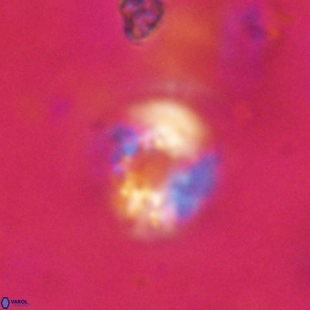 Cribrocorona echinus VR 22931
