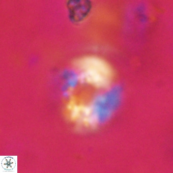 Cribrocorona echinus VR 22931
