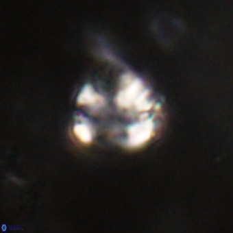 Cribrocorona echinus VR 22932