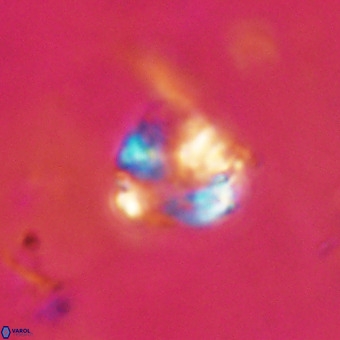 Cribrocorona echinus VR 22933
