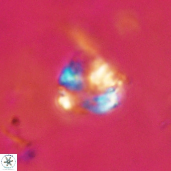 Cribrocorona echinus VR 22933