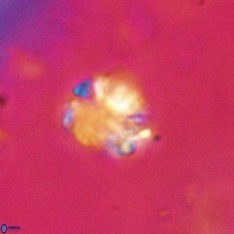 Cribrocorona echinus VR 22934