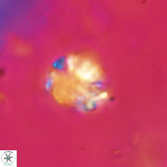 Cribrocorona echinus VR 22934