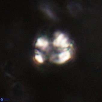 Cribrocorona echinus VR 22935