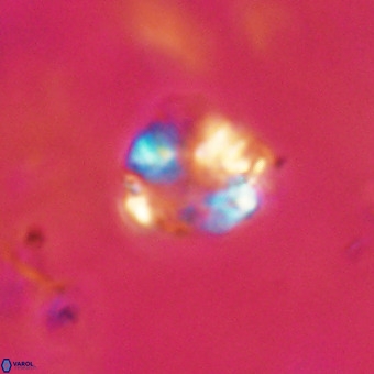 Cribrocorona echinus VR 22936