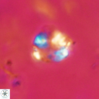 Cribrocorona echinus VR 22936