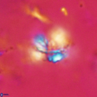 Cribrocorona echinus VR 22937
