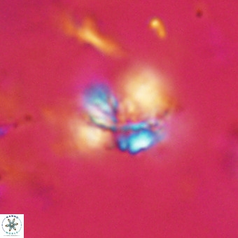 Cribrocorona echinus VR 22937