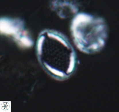 Cribrosphaerella numerosa 10834