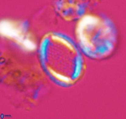 Cribrosphaerella numerosa 10835