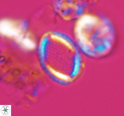 Cribrosphaerella numerosa 10835
