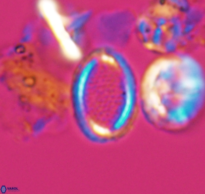 Cribrosphaerella numerosa 10836