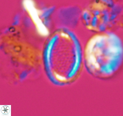 Cribrosphaerella numerosa 10836