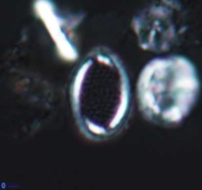 Cribrosphaerella numerosa 10837