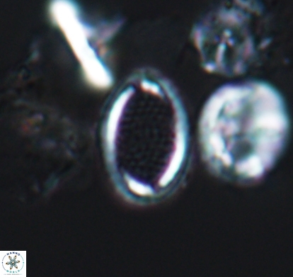 Cribrosphaerella numerosa 10837