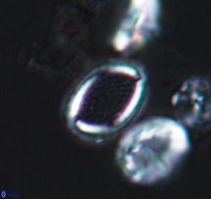 Cribrosphaerella numerosa 10838