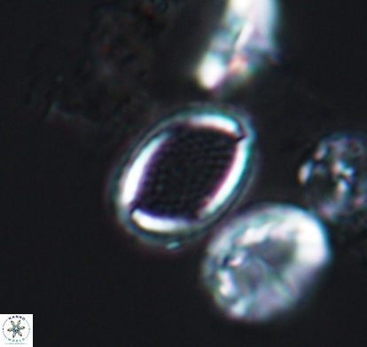 Cribrosphaerella numerosa 10838