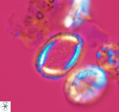Cribrosphaerella numerosa 10839