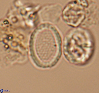 Cribrosphaerella numerosa 10840