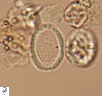 Cribrosphaerella numerosa 10840