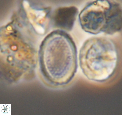 Cribrosphaerella numerosa 10841