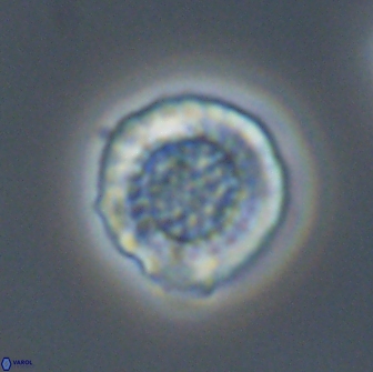 Cribrosphaerella circula 13837