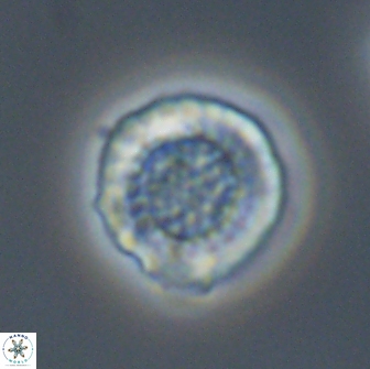 Cribrosphaerella circula 13837