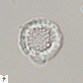 Cribrosphaerella circula 13838