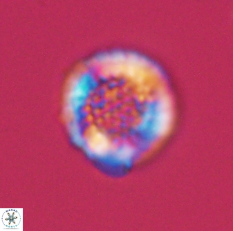 Cribrosphaerella circula 13841