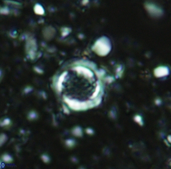 Cribrosphaerella circula 5125