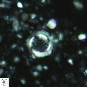 Cribrosphaerella circula 5125