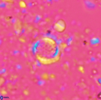 Cribrosphaerella circula 5126