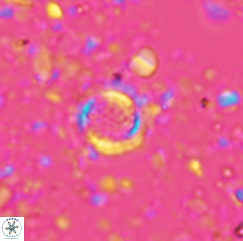 Cribrosphaerella circula 5126
