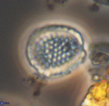 Cribrosphaerella dysmorphia 10480