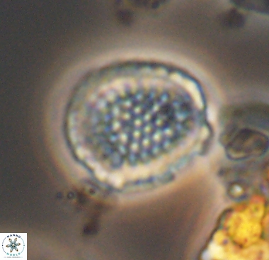 Cribrosphaerella dysmorphia 10480