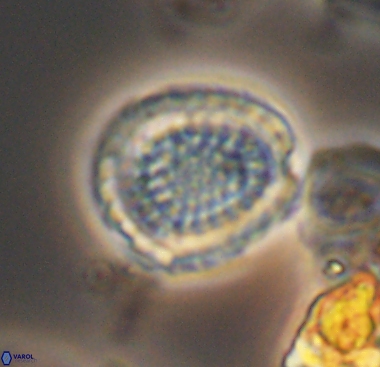 Cribrosphaerella dysmorphia 10481