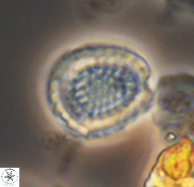 Cribrosphaerella dysmorphia 10481
