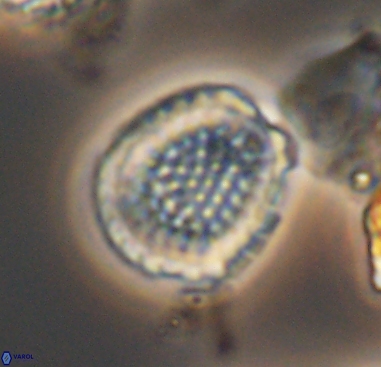 Cribrosphaerella dysmorphia 10482