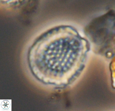 Cribrosphaerella dysmorphia 10482