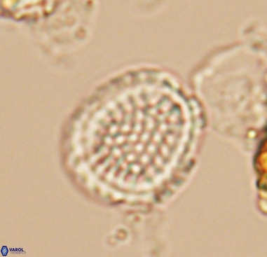 Cribrosphaerella dysmorphia 10483