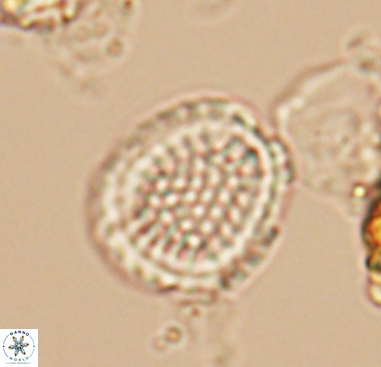 Cribrosphaerella dysmorphia 10483