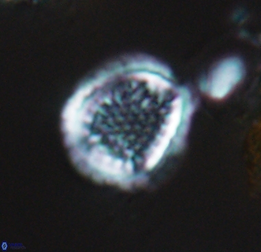 Cribrosphaerella dysmorphia 10484