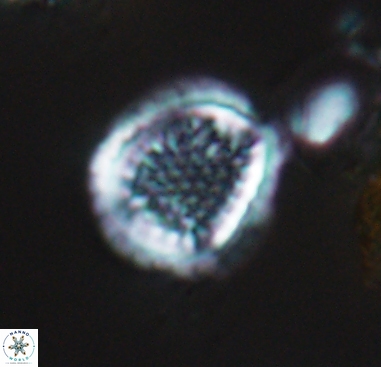 Cribrosphaerella dysmorphia 10484
