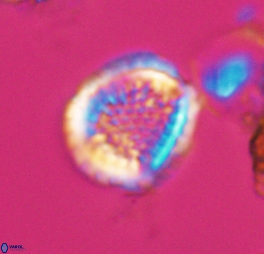 Cribrosphaerella dysmorphia 10485
