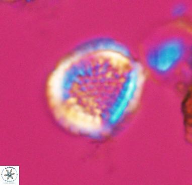 Cribrosphaerella dysmorphia 10485