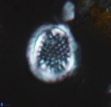 Cribrosphaerella dysmorphia 10486