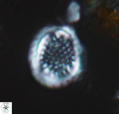 Cribrosphaerella dysmorphia 10486